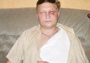 Блогери звинуватили побитого на стадіоні Динамо в українофобії