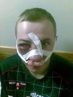 Соратнику з Луганська потрібна допомога