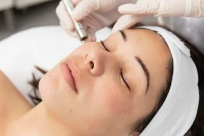 Effortless radiance: The quiet luxury appeal of diamond microdermabrasion